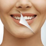 ¿Es suficiente una limpieza dental al año?