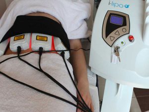 Despejando dudas sobre la lipólisis láser o i- Lipo