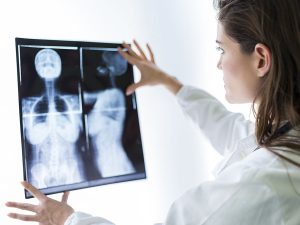 Dispositivos que detectan el cancer de mama ¿los conoces?