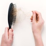 Alopecia: ¿qué es y cuáles son las principales causas?